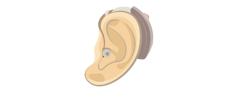 補聴器購入のポイント